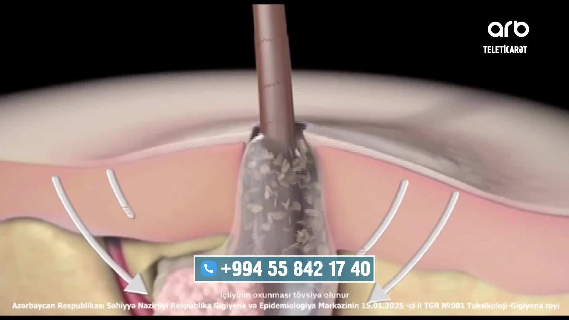 GIA TV Program Thumbnail, Poster
