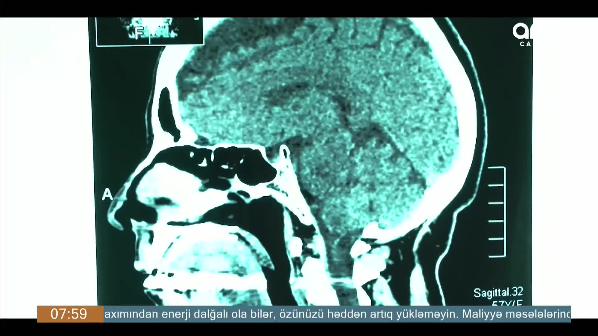 GIA TV Program Thumbnail, Poster