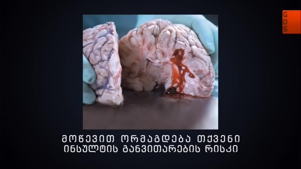 GIA TV Program Thumbnail, Poster