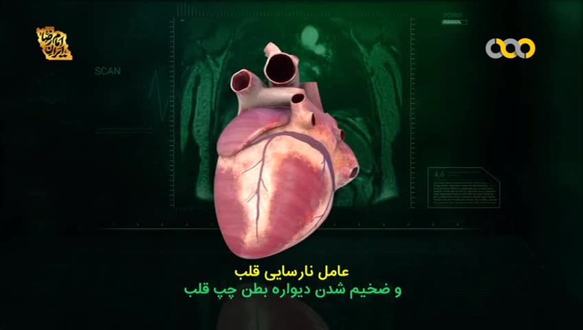 GIA TV Program Thumbnail, Poster