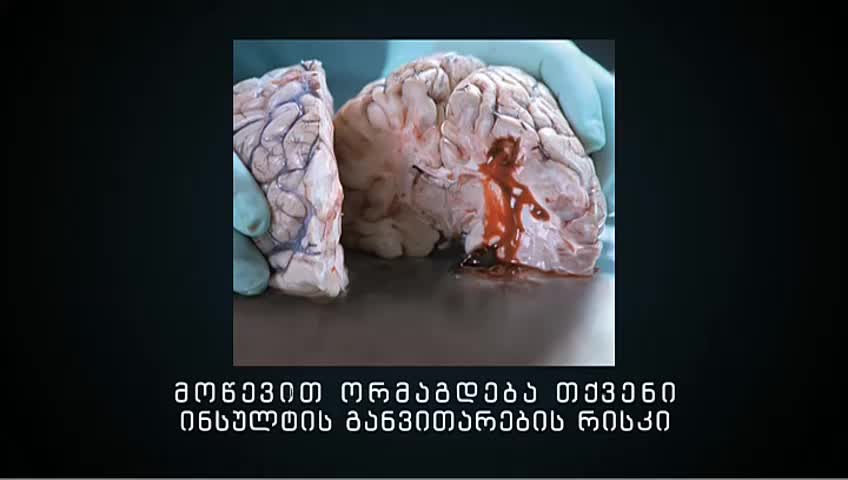 GIA TV Program Thumbnail, Poster