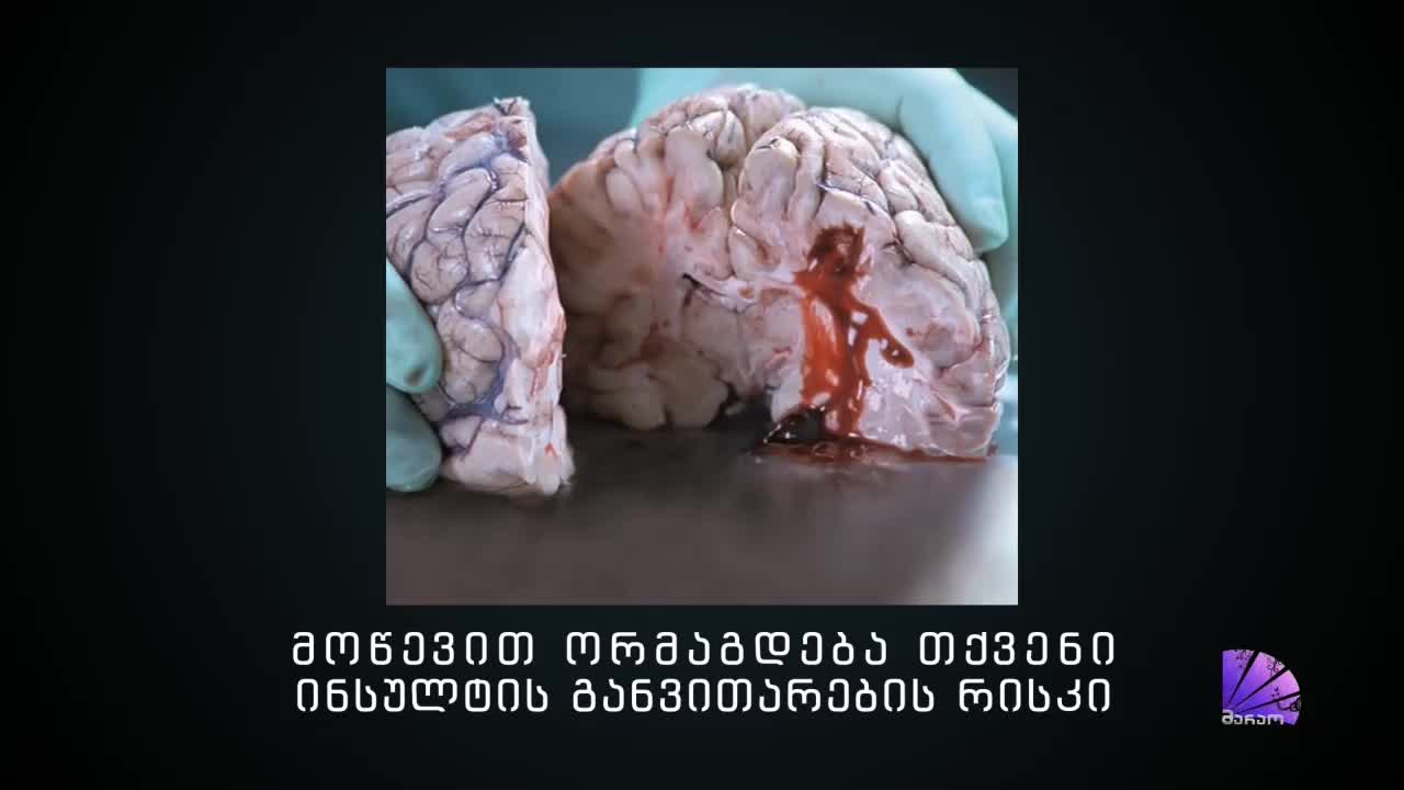 GIA TV Program Thumbnail, Poster