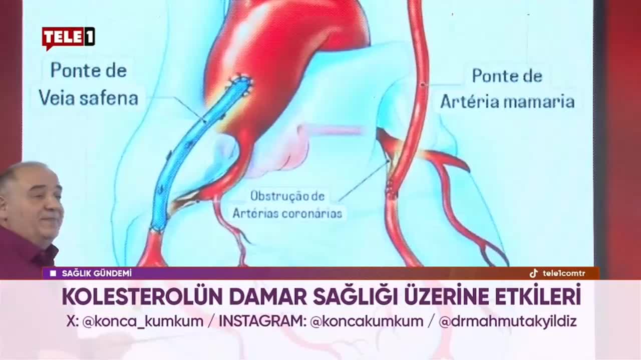 GIA TV Program Thumbnail, Poster